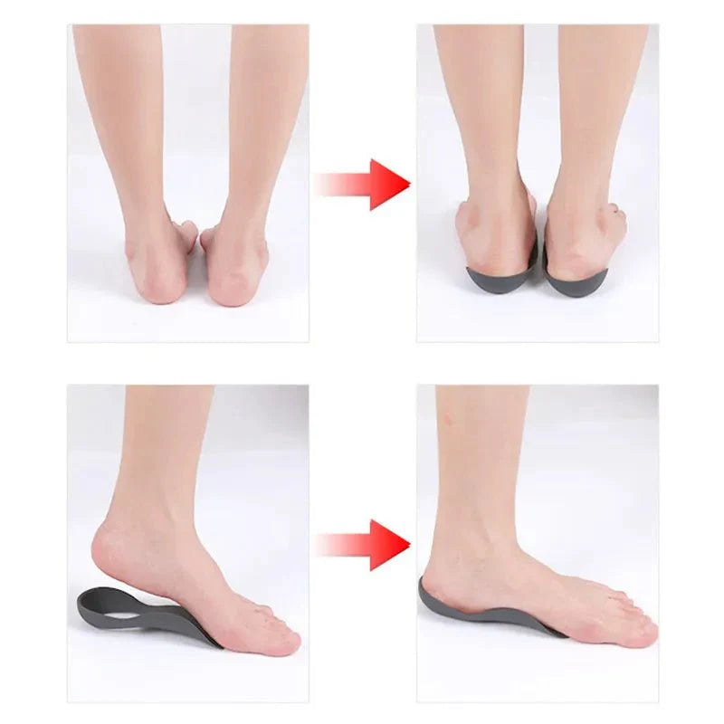 Orthopaedic Insoles - FlexSala
