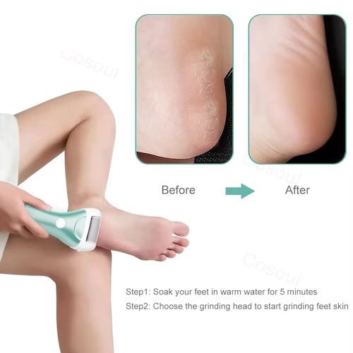 Portable Electric Foot Grinder - FlexSala