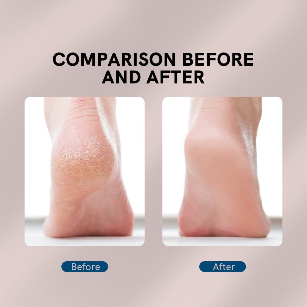Portable Electric Foot Grinder - FlexSala
