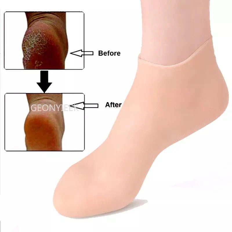 Silicone Feet Care Socks - FlexSala