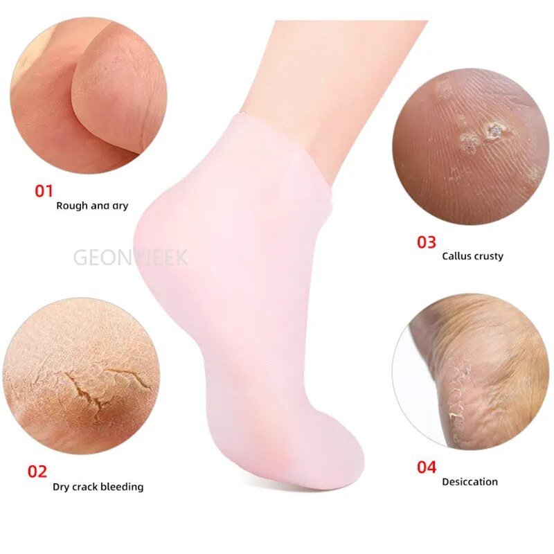 Silicone Feet Care Socks - FlexSala