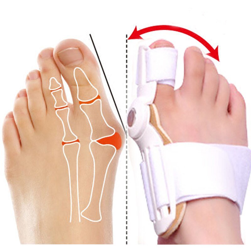 Bunion Corrector™ - FlexSala