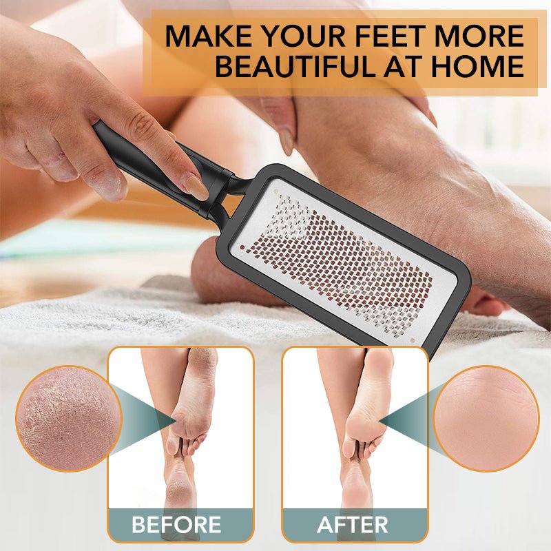Stainless Steel Callus Remover - LightsBetter